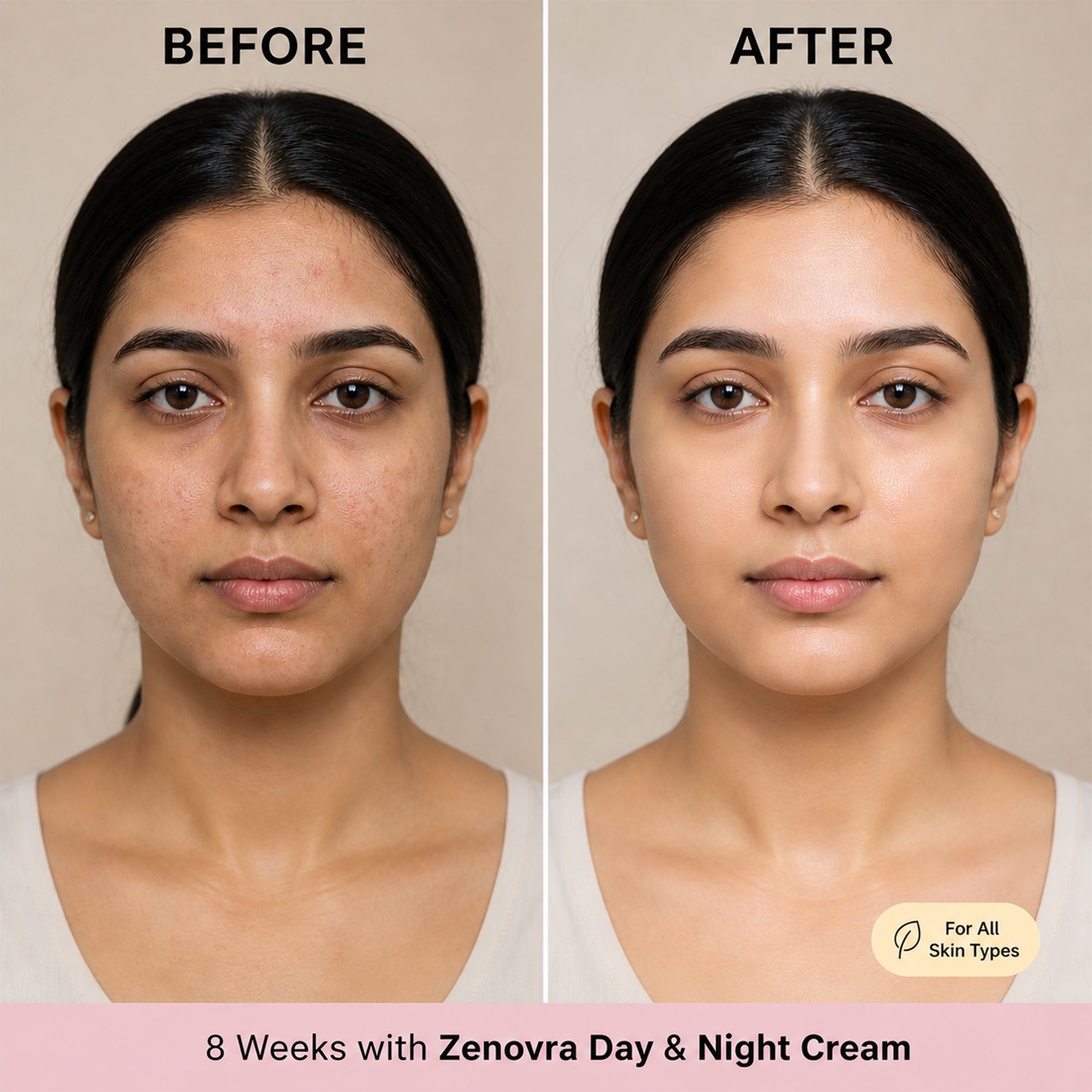 Zenovra Day & Night Cream Combo